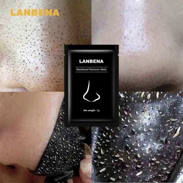 Lanbena Blackhead Remover Nose Mask